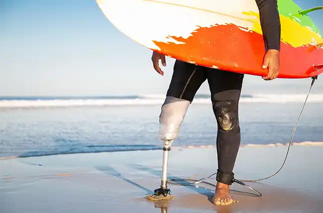 Mann mit einer Beinprothese steht am Strand mit einem Surfbrett